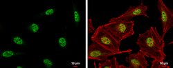 Invitrogen DNA-PK Polyclonal Antibody 100 &mu;L; Unconjugated:Antibodies,