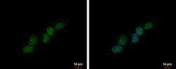 Invitrogen PHOX2B Polyclonal Antibody 100 &mu;L; Unconjugated:Antibodies,