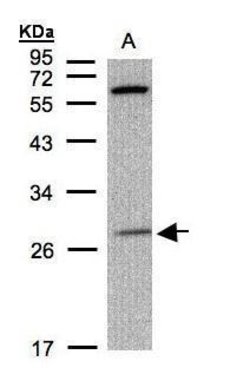 Invitrogen PHOX2B Polyclonal Antibody 100 &mu;L; Unconjugated:Antibodies,