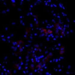 Invitrogen Cytokeratin 7 Polyclonal Antibody 100 &mu;L; Unconjugated:Antibodies,