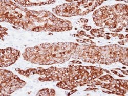 Invitrogen Cytokeratin 7 Polyclonal Antibody 100 &mu;L; Unconjugated:Antibodies,