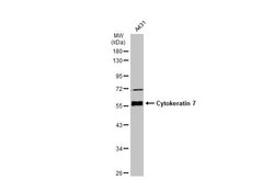 Invitrogen Cytokeratin 7 Polyclonal Antibody 100 &mu;L; Unconjugated:Antibodies,