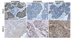 Invitrogen Cytokeratin 7 Polyclonal Antibody 100 &mu;L; Unconjugated:Antibodies,
