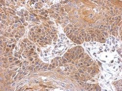 Gephyrin Polyclonal Antibody:Antibodies, Polyclonal
