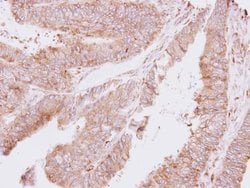 Invitrogen TARS Polyclonal Antibody 100 &mu;L | Buy Online | Invitrogen&trade; | Fisher Scientific