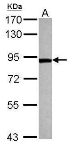 Invitrogen TARS Polyclonal Antibody 100 &mu;L | Buy Online | Invitrogen&trade; | Fisher Scientific
