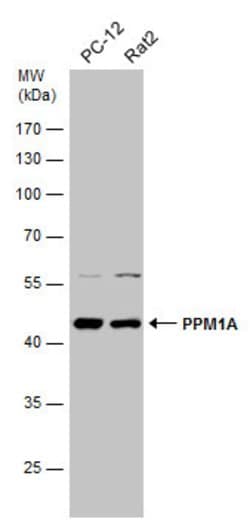 Invitrogen PPM1A Polyclonal Antibody 100 &mu;L | Buy Online | Invitrogen&trade; | Fisher Scientific