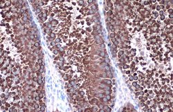Invitrogen HSP90 alpha Polyclonal Antibody 100 &mu;L | Buy Online | Invitrogen&trade; | Fisher Scientific
