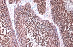Invitrogen HSP90 alpha Polyclonal Antibody 100 &mu;L | Buy Online | Invitrogen&trade; | Fisher Scientific