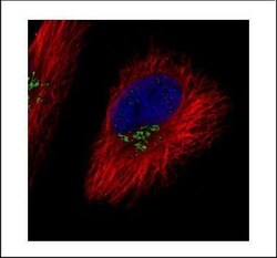 Invitrogen COG7 Polyclonal Antibody 100 &mu;L; Unconjugated:Antibodies,