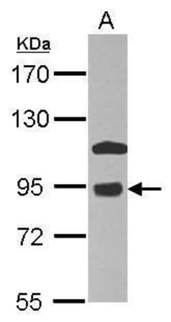 Invitrogen COG7 Polyclonal Antibody 100 &mu;L; Unconjugated:Antibodies,