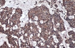 Invitrogen GAA Polyclonal Antibody 100 &mu;L; Unconjugated:Antibodies,