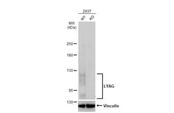 Invitrogen GAA Polyclonal Antibody 100 &mu;L; Unconjugated:Antibodies,