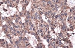 Invitrogen GAA Polyclonal Antibody 100 &mu;L; Unconjugated:Antibodies,
