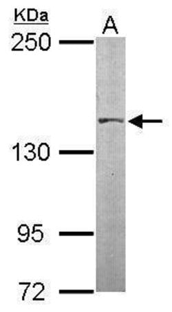 Invitrogen SMC3 Polyclonal Antibody 100 &mu;L; Unconjugated:Antibodies,