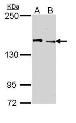 Invitrogen JARID1C Polyclonal Antibody 100 &mu;L; Unconjugated:Antibodies,