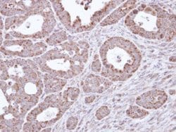 Invitrogen B3GALTL Polyclonal Antibody 100 &mu;L; Unconjugated:Antibodies,
