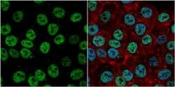 EXO1 Polyclonal Antibody:Antibodies, Polyclonal