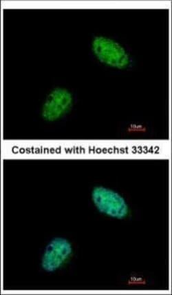 Invitrogen EXO1 Polyclonal Antibody 100 &mu;L | Buy Online | Invitrogen&trade; | Fisher Scientific