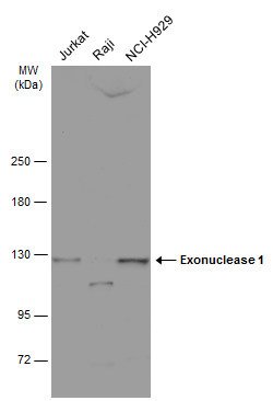 EXO1 Polyclonal Antibody:Antibodies, Polyclonal