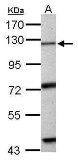 EXO1 Polyclonal Antibody:Antibodies, Polyclonal