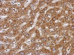 Invitrogen BAAT Polyclonal Antibody 100 μL; Unconjugated:Antibodies,