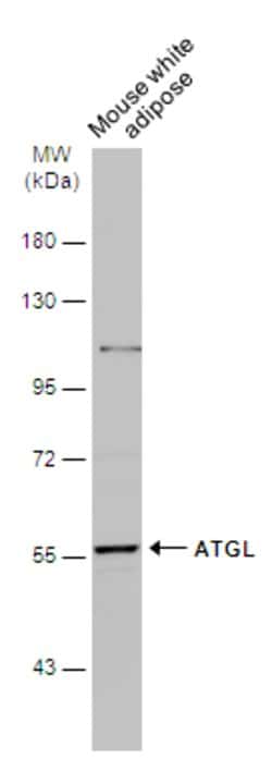 ATGL Polyclonal Antibody:Antibodies, Polyclonal