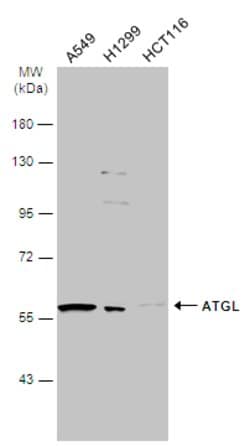ATGL Polyclonal Antibody:Antibodies, Polyclonal