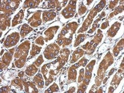 CFHR5 Polyclonal Antibody:Antibodies, Polyclonal