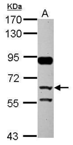 CFHR5 Polyclonal Antibody:Antibodies, Polyclonal