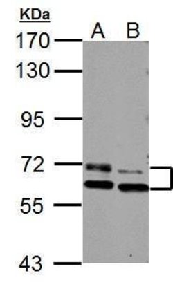 Invitrogen PAK3 Polyclonal Antibody 100 &mu;L; Unconjugated:Antibodies,