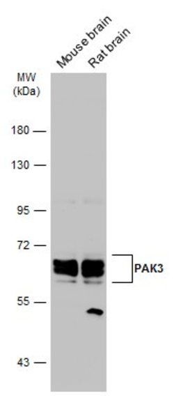 Invitrogen PAK3 Polyclonal Antibody 100 &mu;L; Unconjugated:Antibodies,