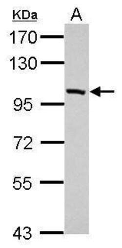 Invitrogen PDE11A Polyclonal Antibody 100 &mu;L; Unconjugated:Antibodies,