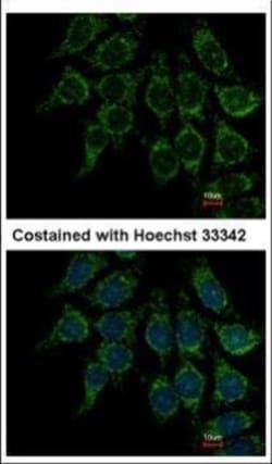 Invitrogen Villin Polyclonal Antibody 100 &mu;L | Buy Online | Invitrogen&trade; | Fisher Scientific