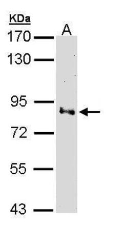 Invitrogen Villin Polyclonal Antibody 100 &mu;L | Buy Online | Invitrogen&trade; | Fisher Scientific