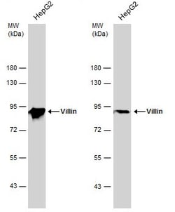 Invitrogen Villin Polyclonal Antibody 100 &mu;L | Buy Online | Invitrogen&trade; | Fisher Scientific