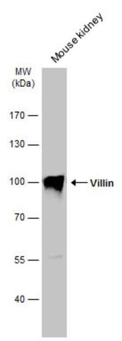 Invitrogen Villin Polyclonal Antibody 100 &mu;L | Buy Online | Invitrogen&trade; | Fisher Scientific
