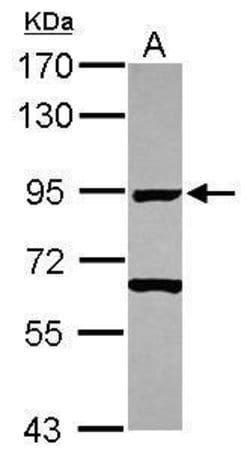 Invitrogen Ku80 Polyclonal Antibody 100 &mu;L; Unconjugated:Antibodies,