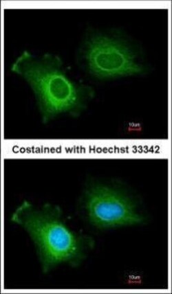 Invitrogen CYP2R1 Polyclonal Antibody 100 &mu;L; Unconjugated:Antibodies,