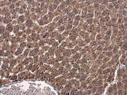 CYP2R1 Polyclonal Antibody:Antibodies, Polyclonal