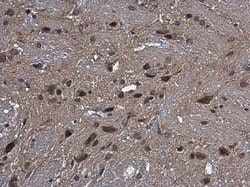 CYP2R1 Polyclonal Antibody:Antibodies, Polyclonal
