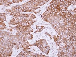 CYP2R1 Polyclonal Antibody:Antibodies, Polyclonal
