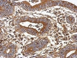 Invitrogen GC Polyclonal Antibody 100 &mu;L | Buy Online | Invitrogen&trade; | Fisher Scientific
