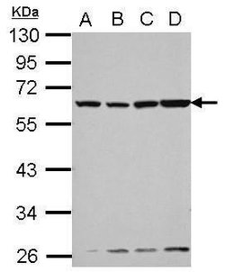 Invitrogen GC Polyclonal Antibody 100 &mu;L | Buy Online | Invitrogen&trade; | Fisher Scientific