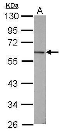 Invitrogen GC Polyclonal Antibody 100 &mu;L | Buy Online | Invitrogen&trade; | Fisher Scientific