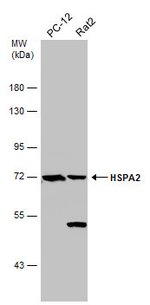 HSPA2 Polyclonal Antibody, Invitrogen™