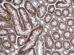 cIAP1 Polyclonal Antibody:Antibodies, Polyclonal