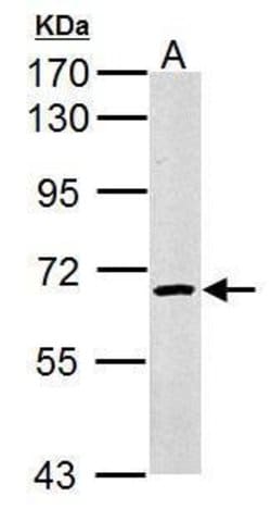 cIAP1 Polyclonal Antibody:Antibodies, Polyclonal