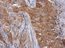 Invitrogen Tara Polyclonal Antibody 100 &mu;L; Unconjugated:Antibodies,