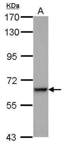 Invitrogen Complement C9 Polyclonal Antibody 100 &mu;L; Unconjugated:Antibodies,